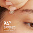 CeraVe Anti-Unreinheiten Patches CeraVe