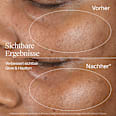 Serum Collagen Bank 15% Vitamin C Neutrogena