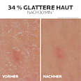 LA ROCHE-POSAY Lipikar Gel Urea 30% Anti-Verhornung LA ROCHE-POSAY
