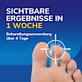 Warzen Entferner Behandlungsstift Scholl