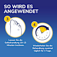 Warzen Entferner Behandlungsstift Scholl
