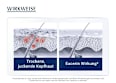 Eucerin Dermo Capillaire 5% Urea kopfhautberuhigendes Intensiv-Tonikum Eucerin