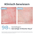 Eucerin Atopi Control beruhigender leichter Balsam Basispflege bei Neurodermitis Eucerin