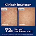 Eucerin Urea Repair Plus 10% Urea Lotion Eucerin