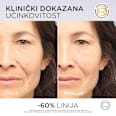 Revitalift Filler serum protiv bora L'ORÉAL PARiS REVITALIFT