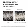VICHY DERCOS Anti-Schuppen Shampoo normale-trockene Kopfhaut VICHY LABORATOIRES