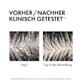 VICHY DERCOS Anti-Schuppen 2in1 Shampoo + Pflegespülung VICHY LABORATOIRES