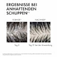 VICHY Dercos Anti-Schuppen Shampoo: Beruhigendes Shampoo mit Salicylsäure für normales bis fettiges Haar VICHY LABORATOIRES