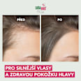 šampon na vlasy proti vypadávání sebamed