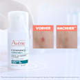 Avène Cleanance Comedomed+ Intensiv Anti-Unreinheiten Konzentrat Avène