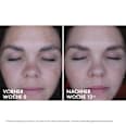 VICHY LIFTACTIV B3 Nachtcreme Anti-Pigmentflecken mit purem Retinol VICHY LABORATOIRES