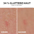 LA ROCHE-POSAY Lipikar Gel Urea 30% Anti-Verhornung LA ROCHE-POSAY