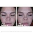VICHY LIFTACTIV B3 Nachtcreme Anti-Pigmentflecken mit purem Retinol VICHY LABORATOIRES