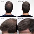 Sprej za prekrivanje izrasta Chestnut L'ORÉAL PARiS MAGIC RETOUCH