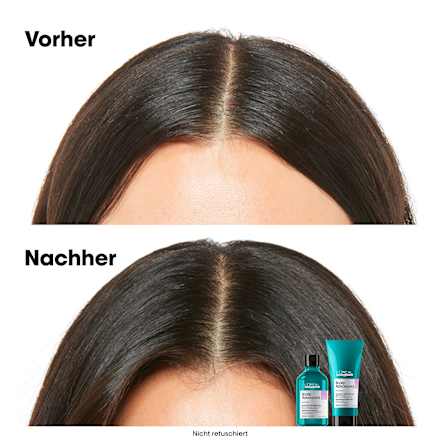 Shampoo Scalp Advanced Dermo Regulator Anti-Discomfort L´Oréal Professionnel