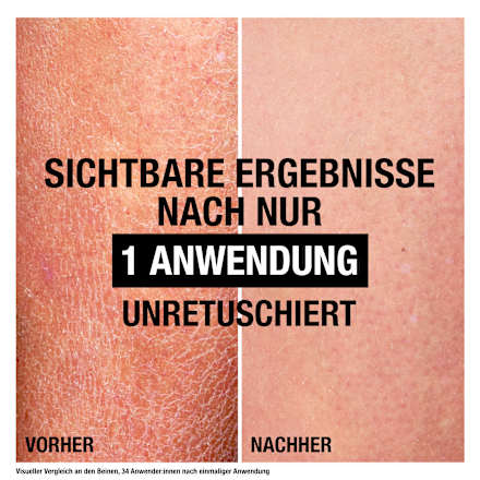 Bodylotion Hautsraffend Neutrogena
