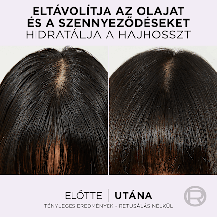 Hajszérum Pure Hyaluron L'ORÉAL PARiS ELSEVE