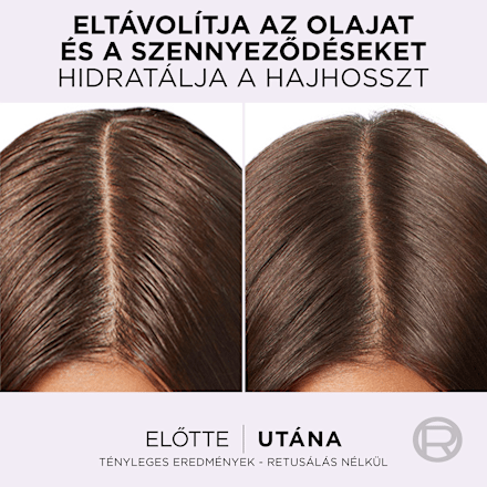 Hajszérum Pure Hyaluron L'ORÉAL PARiS ELSEVE