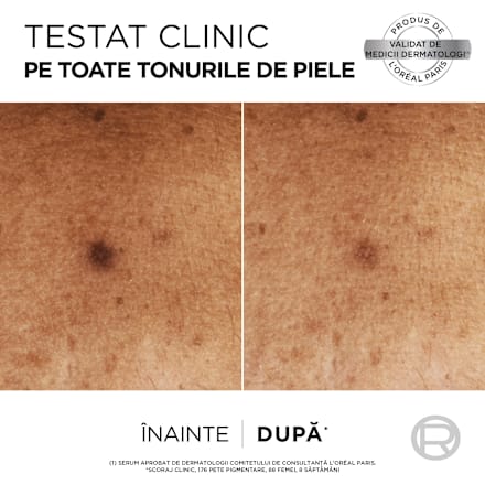 Serum anti pete pigmentare  L'ORÉAL PARiS