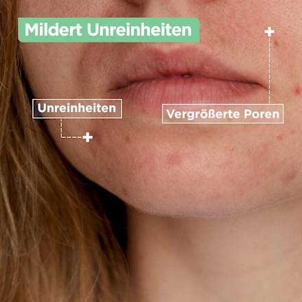Cleanser Anti-Unreinheiten Mixa