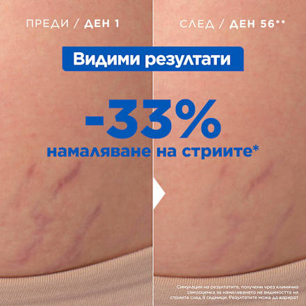 Масло против стрии Mixa