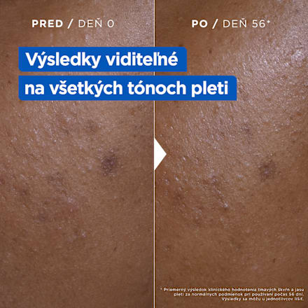 Hydratačný krém proti tmavým škvrnám Niacinamide Bright Mixa