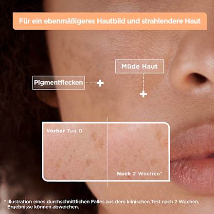 Serum Anti-Pigmentflecken Mixa
