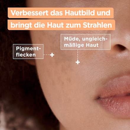 Gesichtscreme Anti-Pigmentflecken Mixa