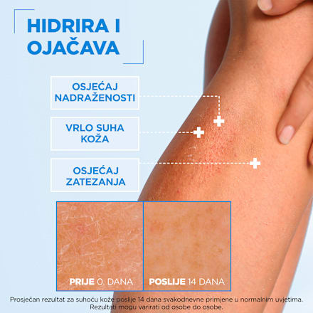 Ceramide Protect krema za jačanje zaštitne barijere kože Mixa