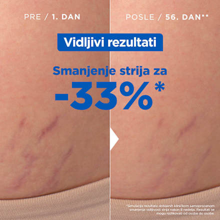 Ulje protiv strija Mixa