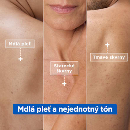 Hydratačný krém proti tmavým škvrnám Niacinamide Bright Mixa