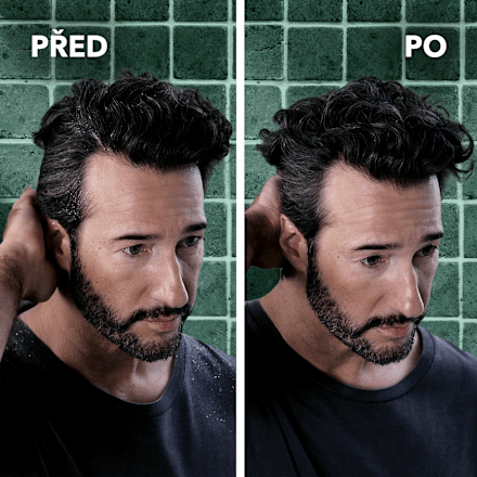 Anti-Dandruff intenzivní šampon proti lupům Intense schauma