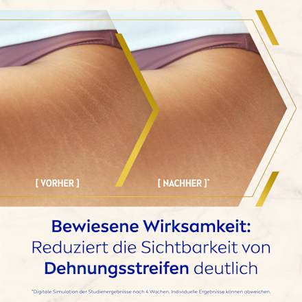 Körperöl Luminous Anti-Dehnungsstreifen NIVEA