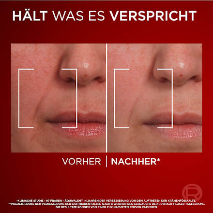 Gesichtpflegeset Revitalift Laseer X3 Tag & Nacht L'ORÉAL PARiS REVITALIFT