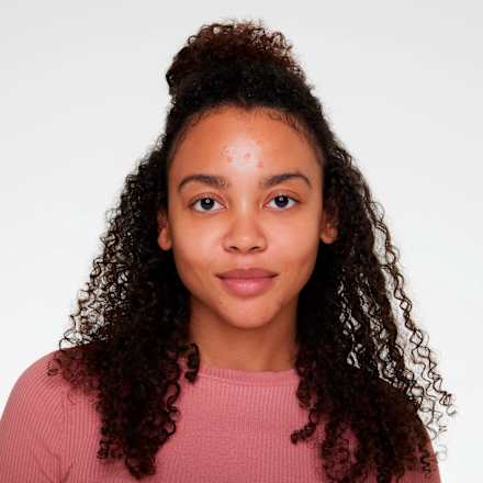 Anti-Pickel-Gel essence