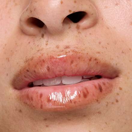 Lippenöl  Hydra Kiss 04 Pocketful Of Sunshine LSF25 essence