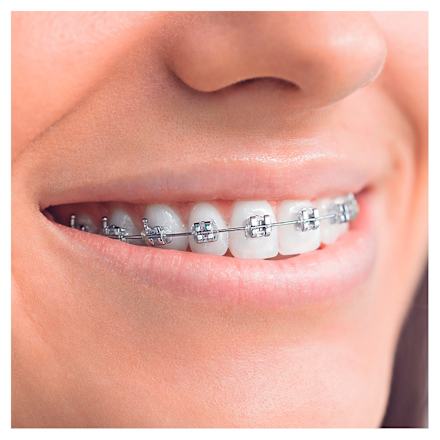 Aufsteckbürsten Ortho Care Essentials Oral-B