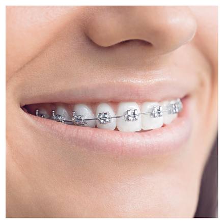 Aufsteckbürsten Ortho Care Essentials Oral-B