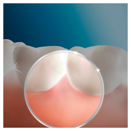 Aufsteckdüsen Munddusche Oxyjet Oral-B