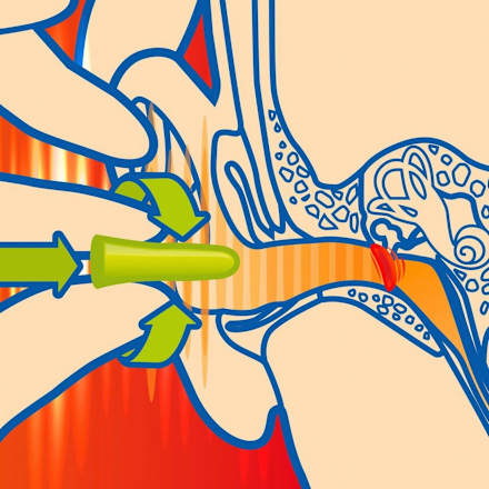 Dopuri de urechi pentru copii Sanohra