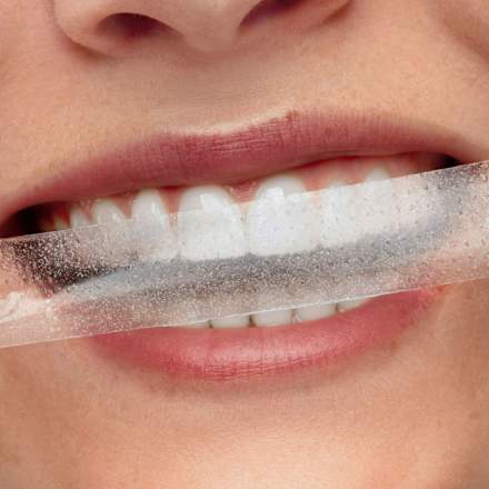 Night Whitening Strips smilepen