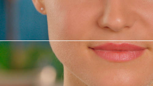 Gesichtshaarentferner, Dermaplane Glow Gesichtspeeling & Haarentfernung Flawless