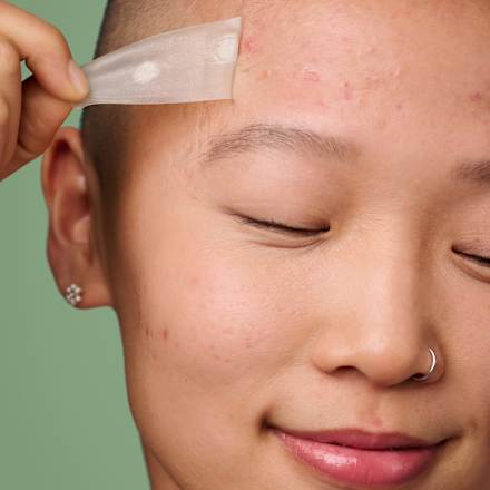 Anti Pickel Patches Mighty Patch Surface Hero.