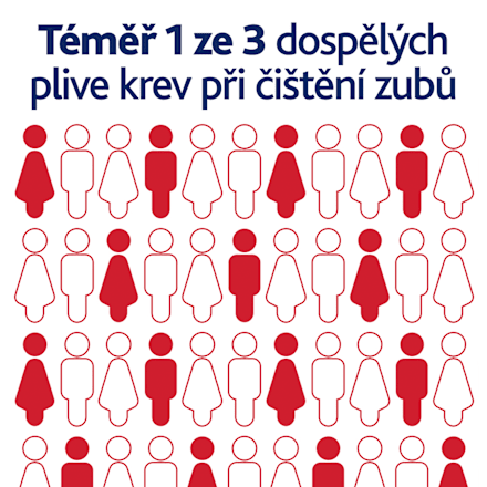zubní pasta Fluoride 2x75 ml parodontax