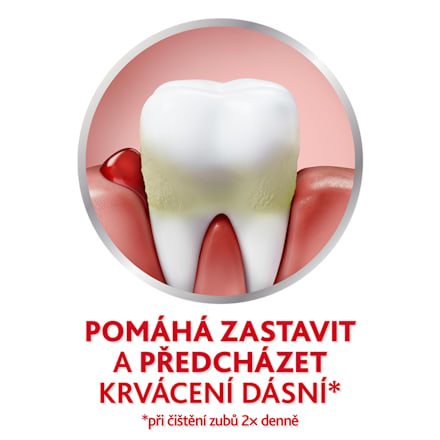zubní pasta Fluoride 2x75 ml parodontax