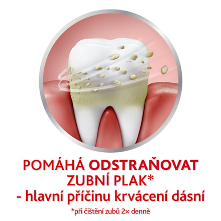 zubní pasta Fluoride 2x75 ml parodontax