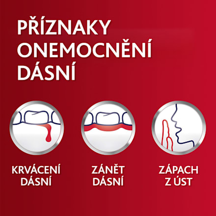 zubní pasta Fluoride 2x75 ml parodontax