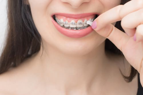Ortho Wachs für Zahnspangen GUM
