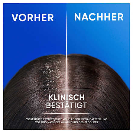 Shampoo Anti-Schuppen 2in1 Classic Clean head&shoulders