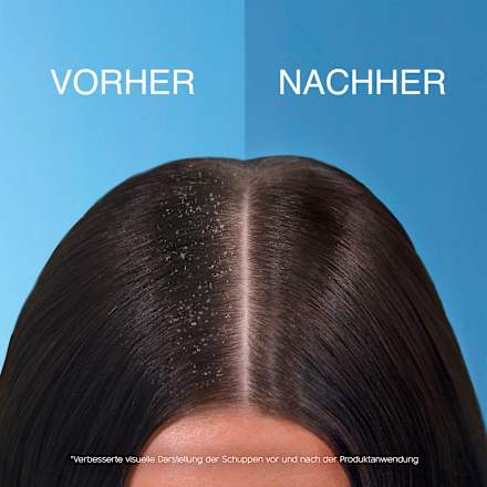 Shampoo Tiefenfeuchtigkeit head&shoulders